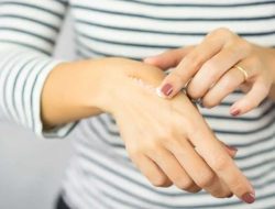 9 Salep Penghilang Bekas Luka Efektif dan Murah