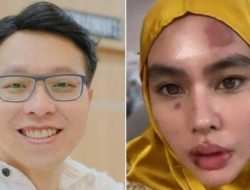 Jejak Dokter Richard Lee yang Kini Ditahan, Dulu Dilaporkan Kartika Putri